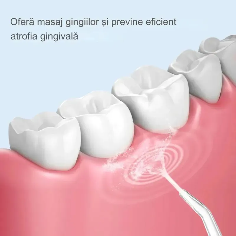 Irigator Bucal Portabil cu 3 Niveluri de Presiune, 4 Capete – Curățare 360° pentru Dinți și Gingii