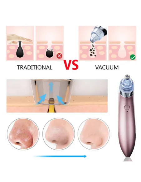 Aspirator Vacuum Facial Cleanser - Puncte Negre, Acnee, Pori